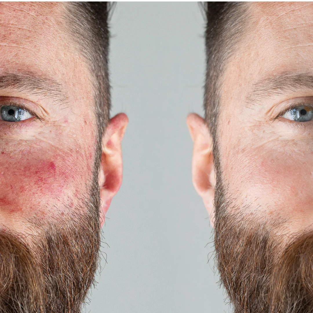 Correcteur visage anti-rougeurs - Image 4